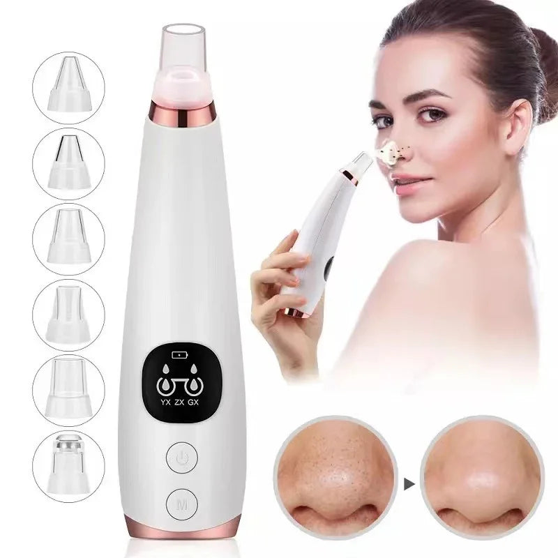 5-in-1 Electric Blackhead Remover Vacuum | Rechargeable Pore Cleaner with Acne Suction & Deep Facial Skin Care Tool