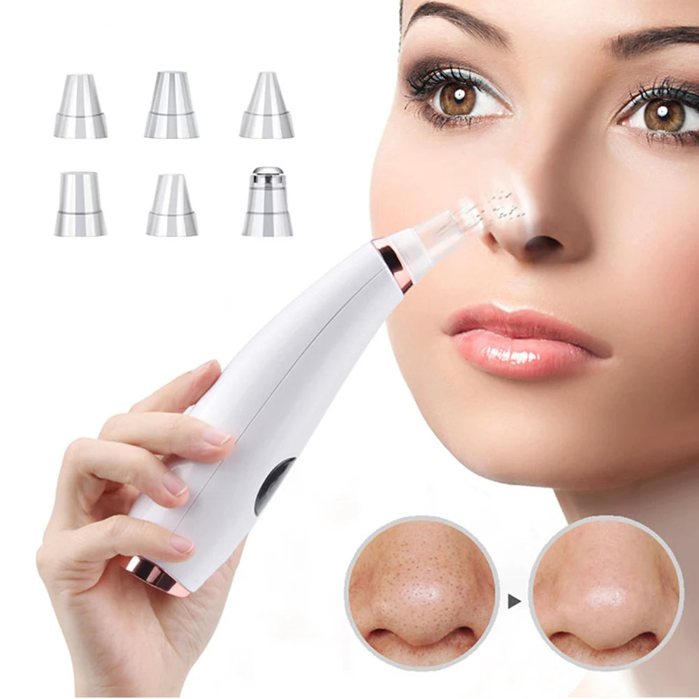 5-in-1 Electric Blackhead Remover Vacuum | Rechargeable Pore Cleaner with Acne Suction & Deep Facial Skin Care Tool
