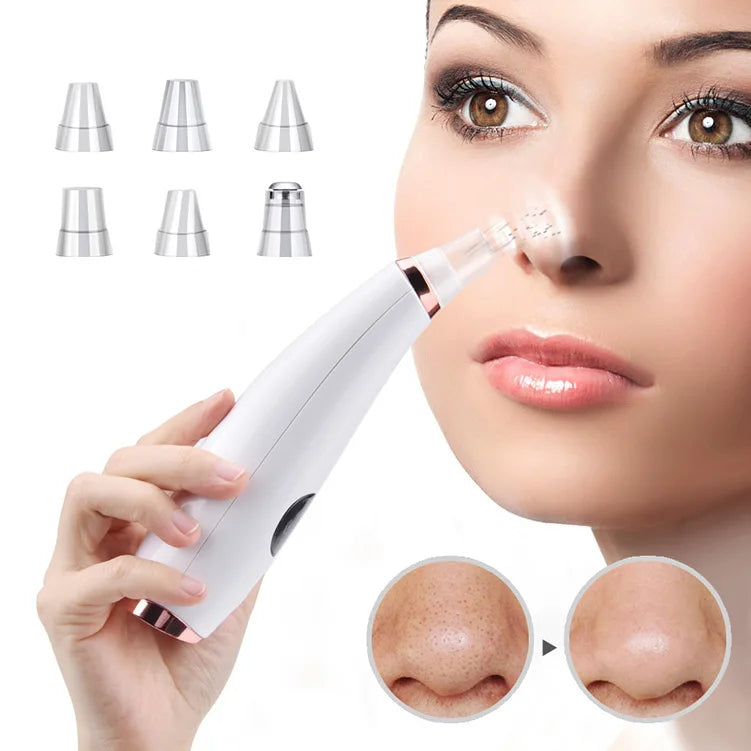 5-in-1 Electric Blackhead Remover Vacuum | Rechargeable Pore Cleaner with Acne Suction & Deep Facial Skin Care Tool