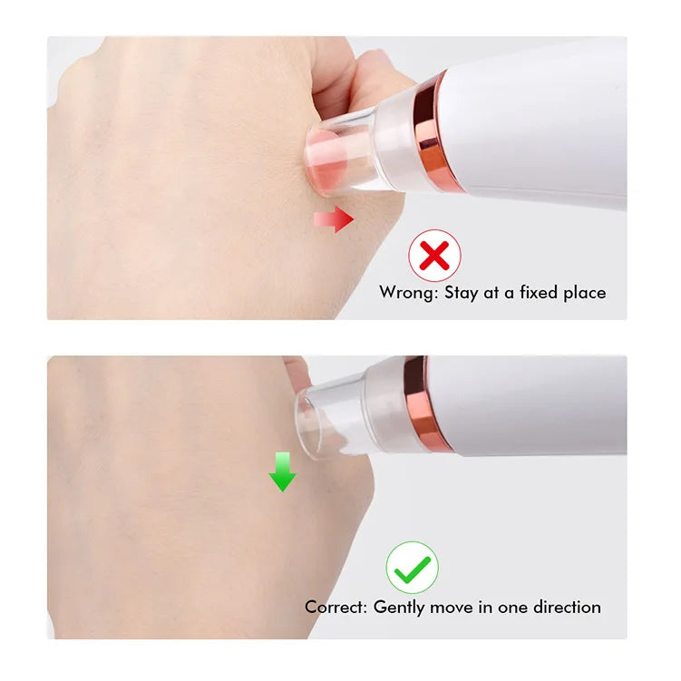 5-in-1 Electric Blackhead Remover Vacuum | Rechargeable Pore Cleaner with Acne Suction & Deep Facial Skin Care Tool