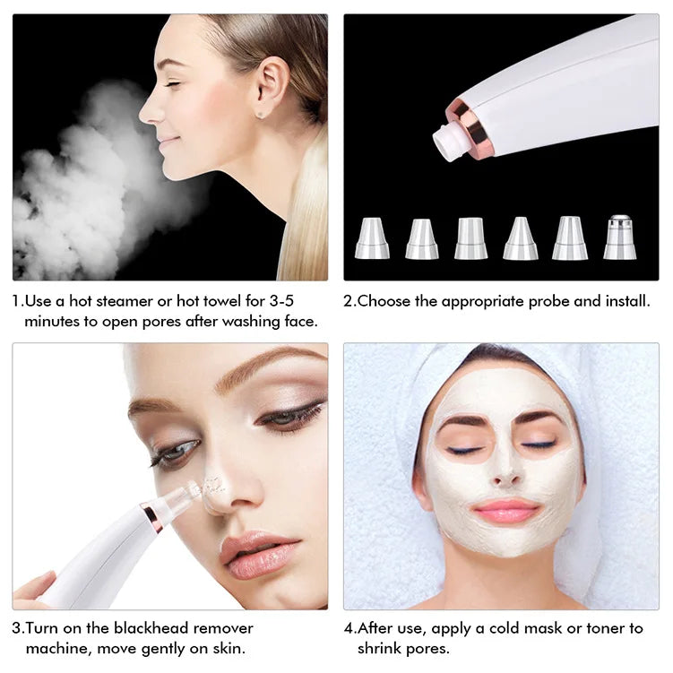 5-in-1 Electric Blackhead Remover Vacuum | Rechargeable Pore Cleaner with Acne Suction & Deep Facial Skin Care Tool